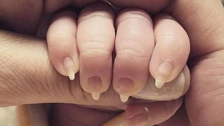 Photo Of Newborn Baby With Sharp Manicured Nails Sparks Debate on the Internet